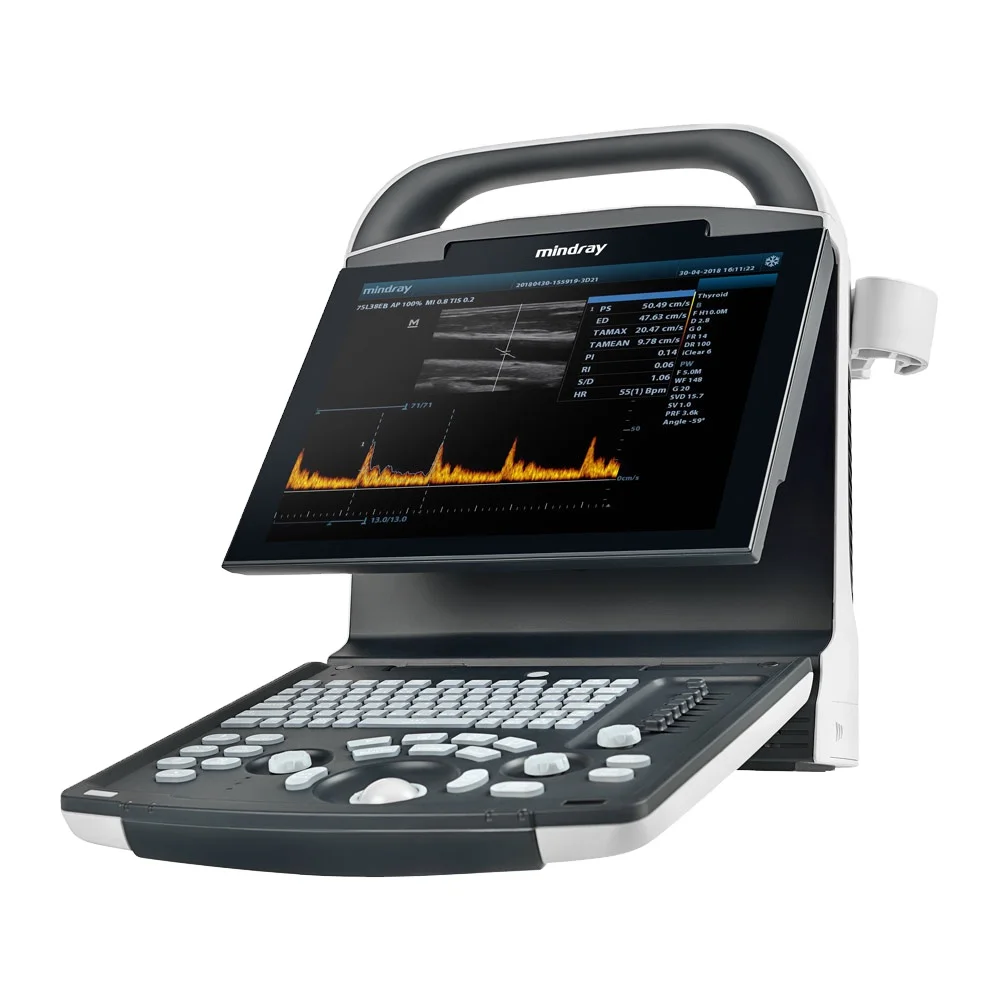 Lacné Ceny Pôvodnej DP10 Mindray Lekárske Ultrazvukové Nástroje Prenosný Ultrazvuk Stroj Čiernej A Bielej Iných Ultrazvukových